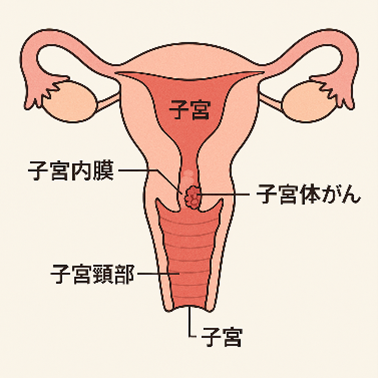 若年層のがん罹患が増えています～若いからこそ予防と早期発見を～　　　　　　　　のアイキャッチ画像